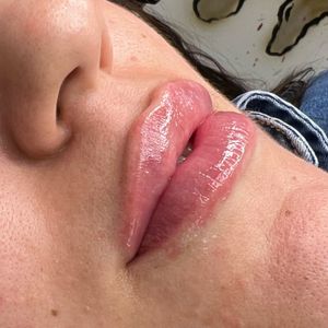 Aesthetic Medicine | Dr. Moshe Amir