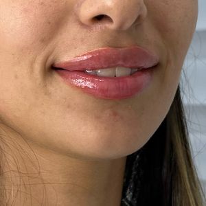 Aesthetic Medicine | Dr. Moshe Amir