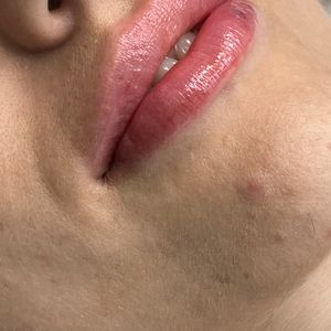 Aesthetic Medicine | Dr. Moshe Amir