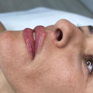 Aesthetic Medicine | Dr. Moshe Amir