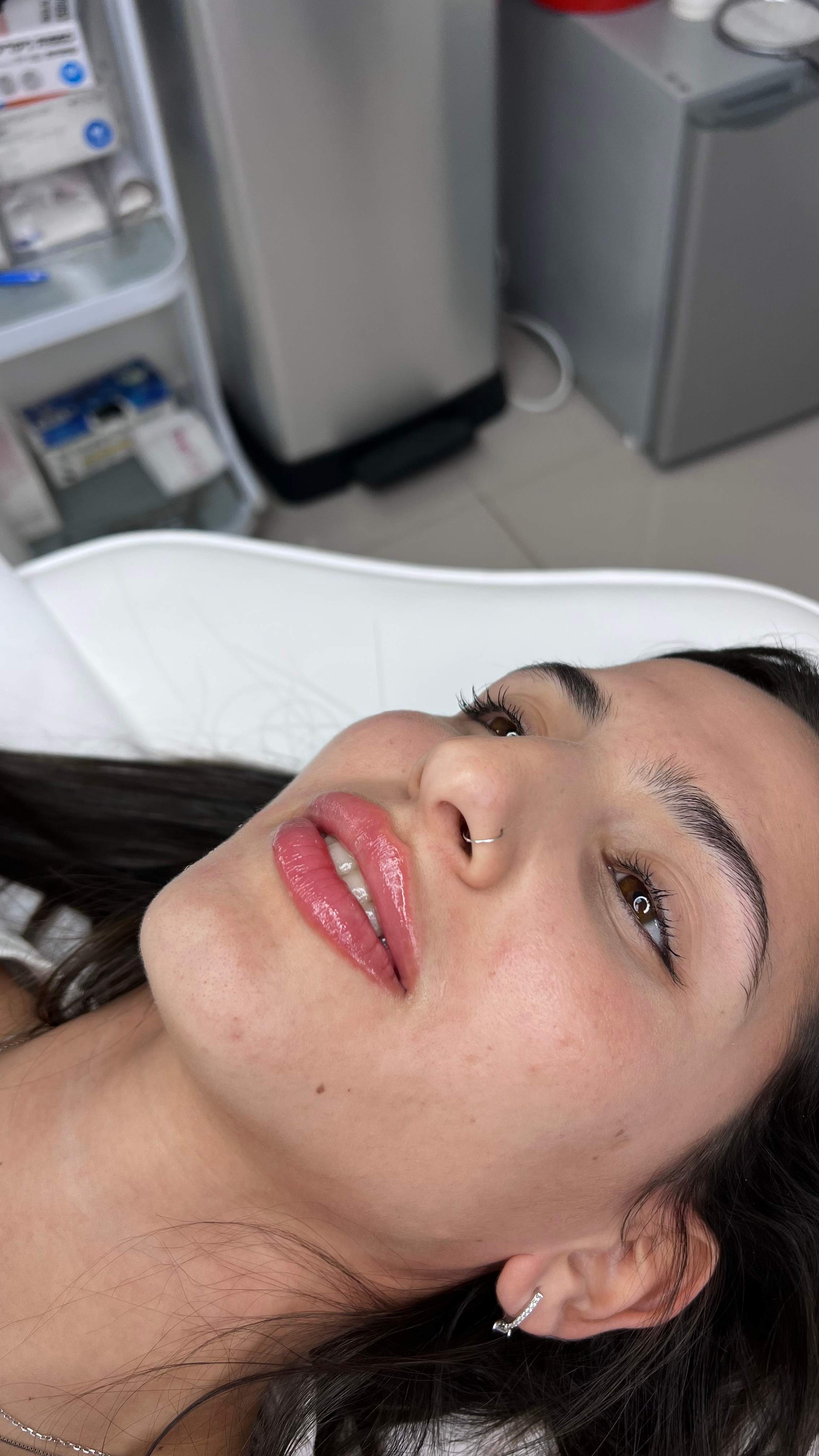 طب التجميل | دكتور موشيه أمير