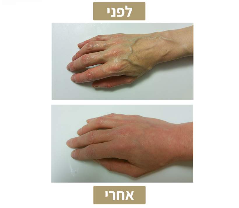 Aesthetic Medicine | Dr. Mony Friedman