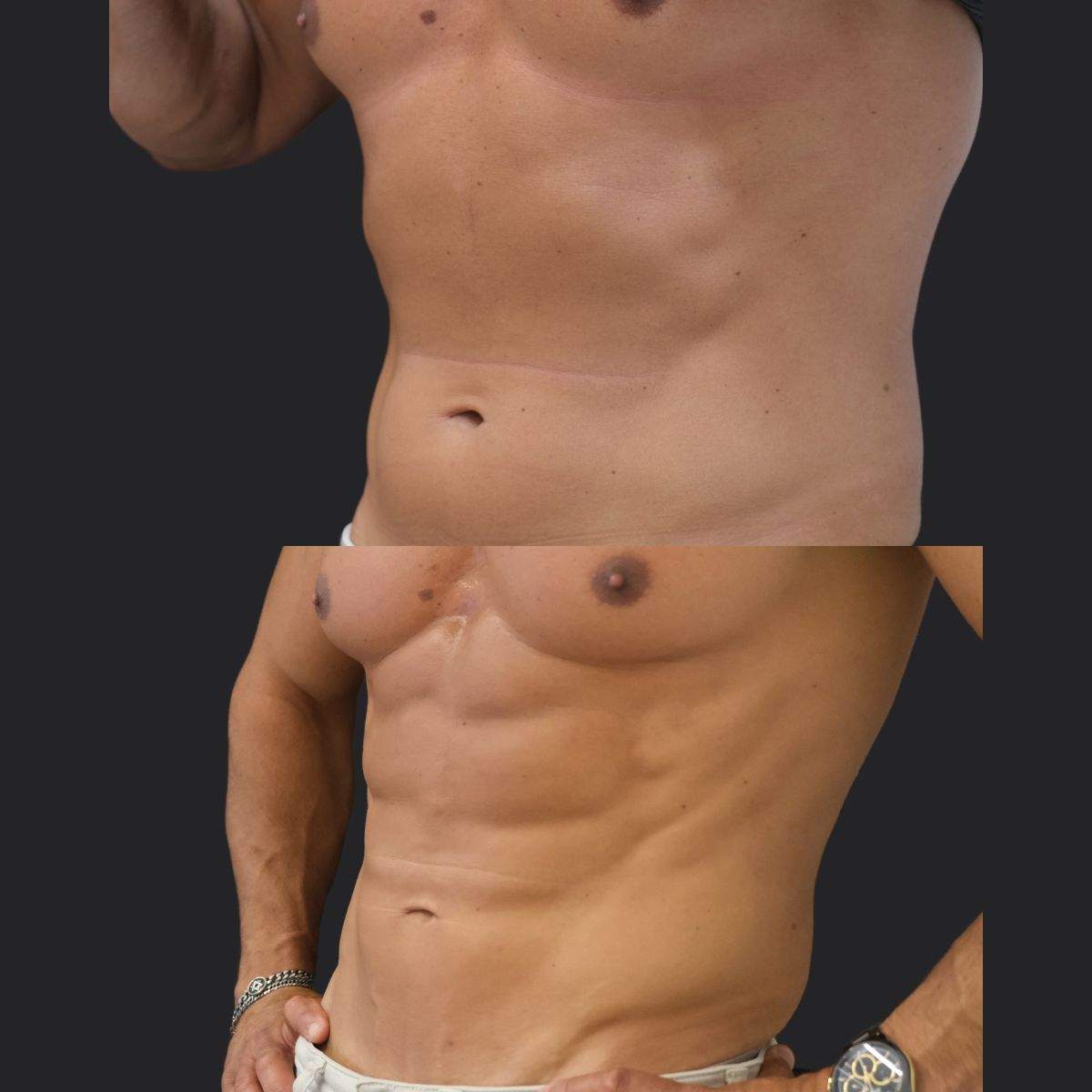 طب التجميل | د. موني فريدمان