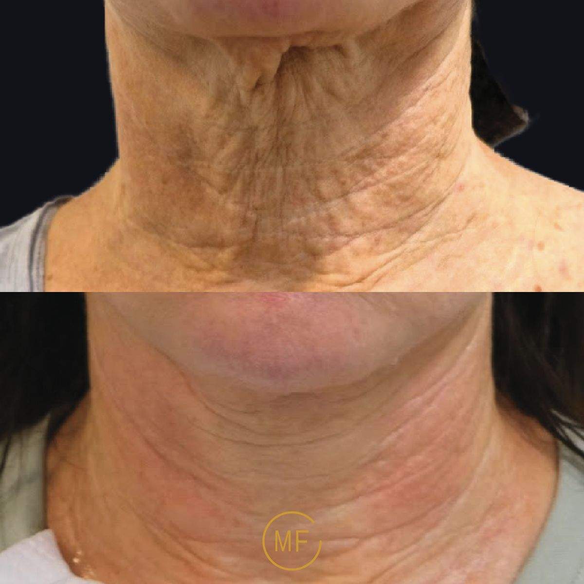 Aesthetic Medicine | Dr. Mony Friedman