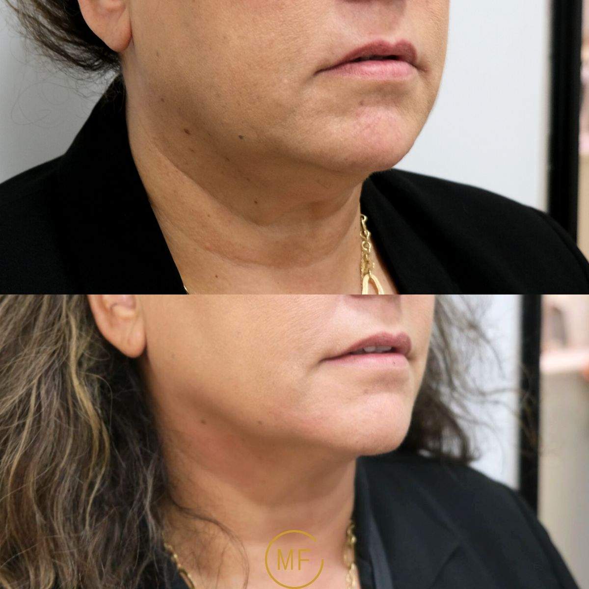 Aesthetic Medicine | Dr. Mony Friedman