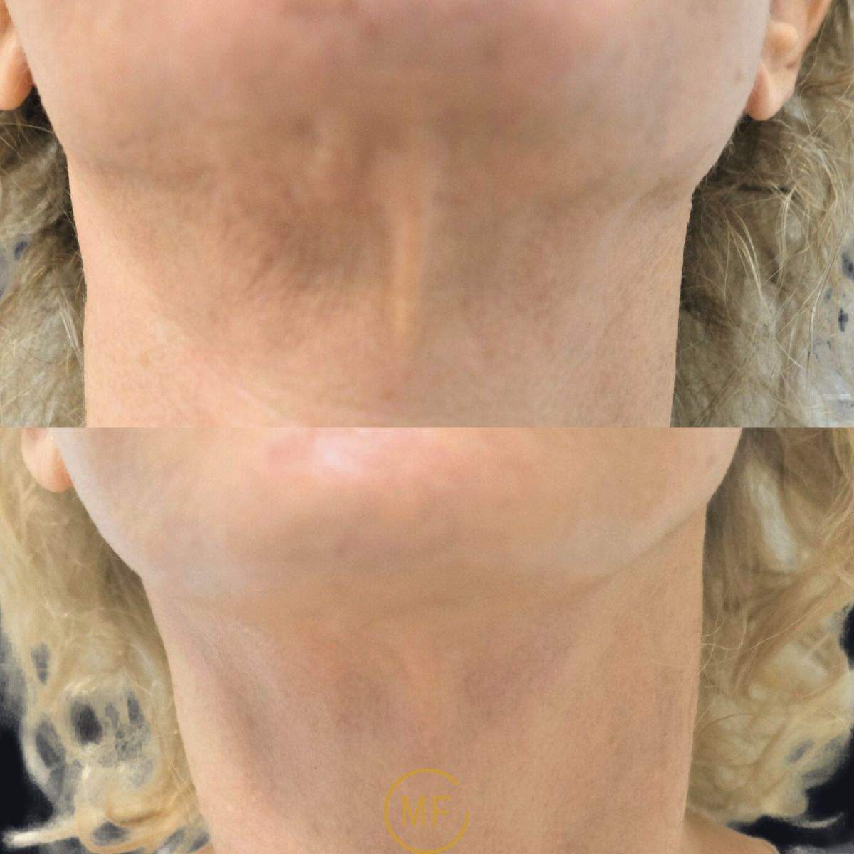 Aesthetic Medicine | Dr. Mony Friedman