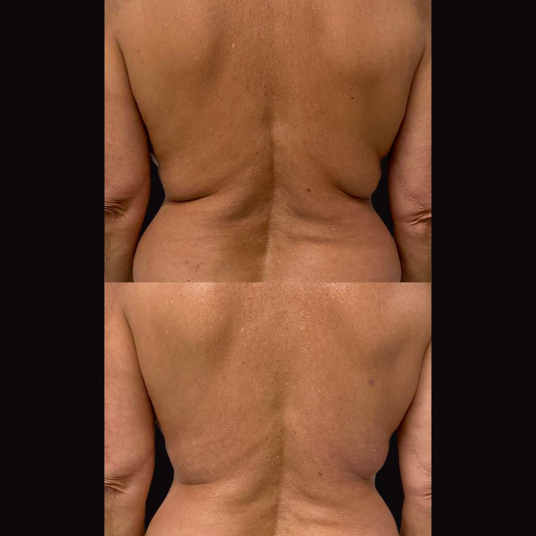 طب التجميل | د. موني فريدمان
