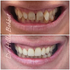 Spécialiste en réadaptation orale | Dr. Hilla Bohbot