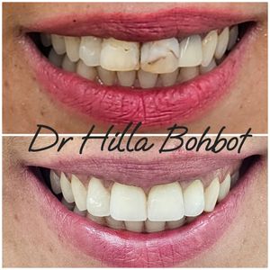 Spécialiste en réadaptation orale | Dr. Hilla Bohbot