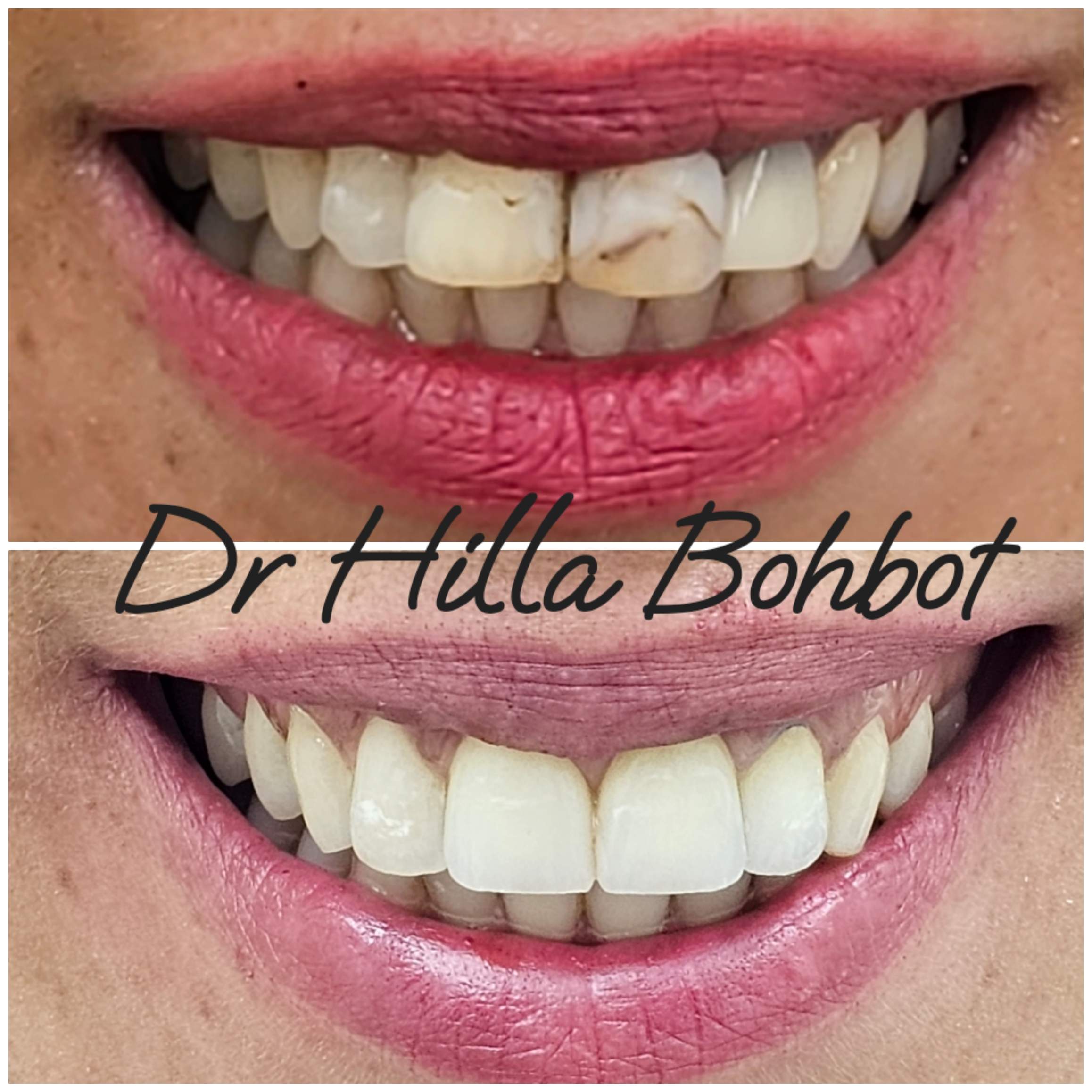 Spécialiste en réadaptation orale | Dr. Hilla Bohbot