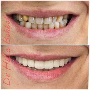 Spécialiste en réadaptation orale | Dr. Hilla Bohbot