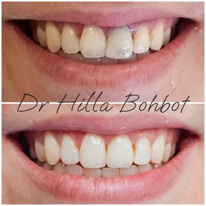 Spécialiste en réadaptation orale | Dr. Hilla Bohbot
