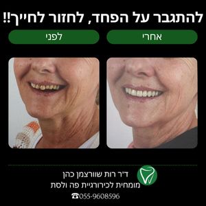 Челюстно-лицевая хирургия - Специалист | Доктор Рут Шварцман Коэн