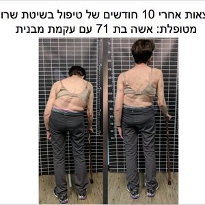 פיזיותרפיה | ד"ר חגית ברדיצ'בסקי
