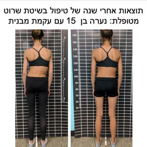 פיזיותרפיה | ד"ר חגית ברדיצ'בסקי