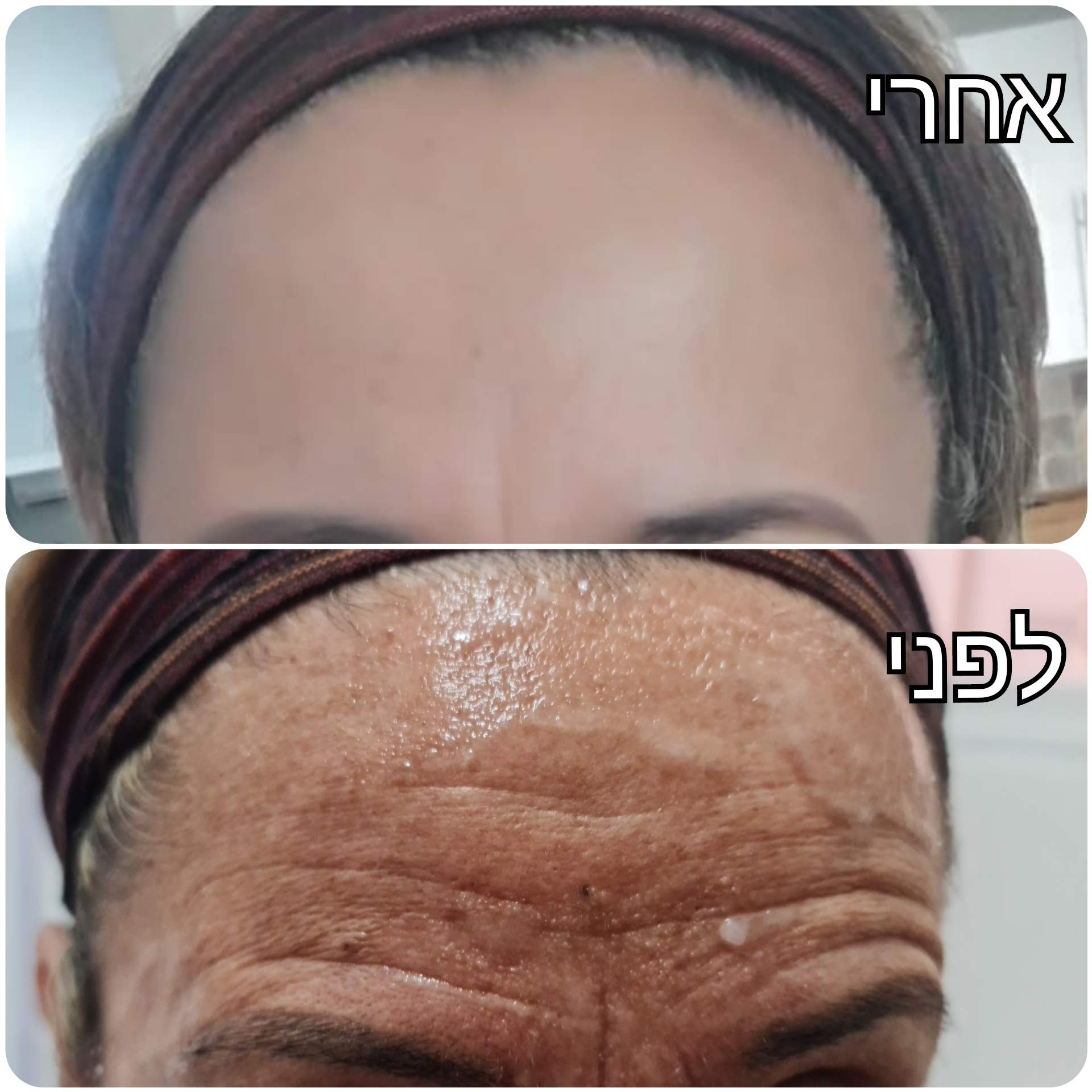 Aesthetic Medicine | Dr. Eitan Levitas
