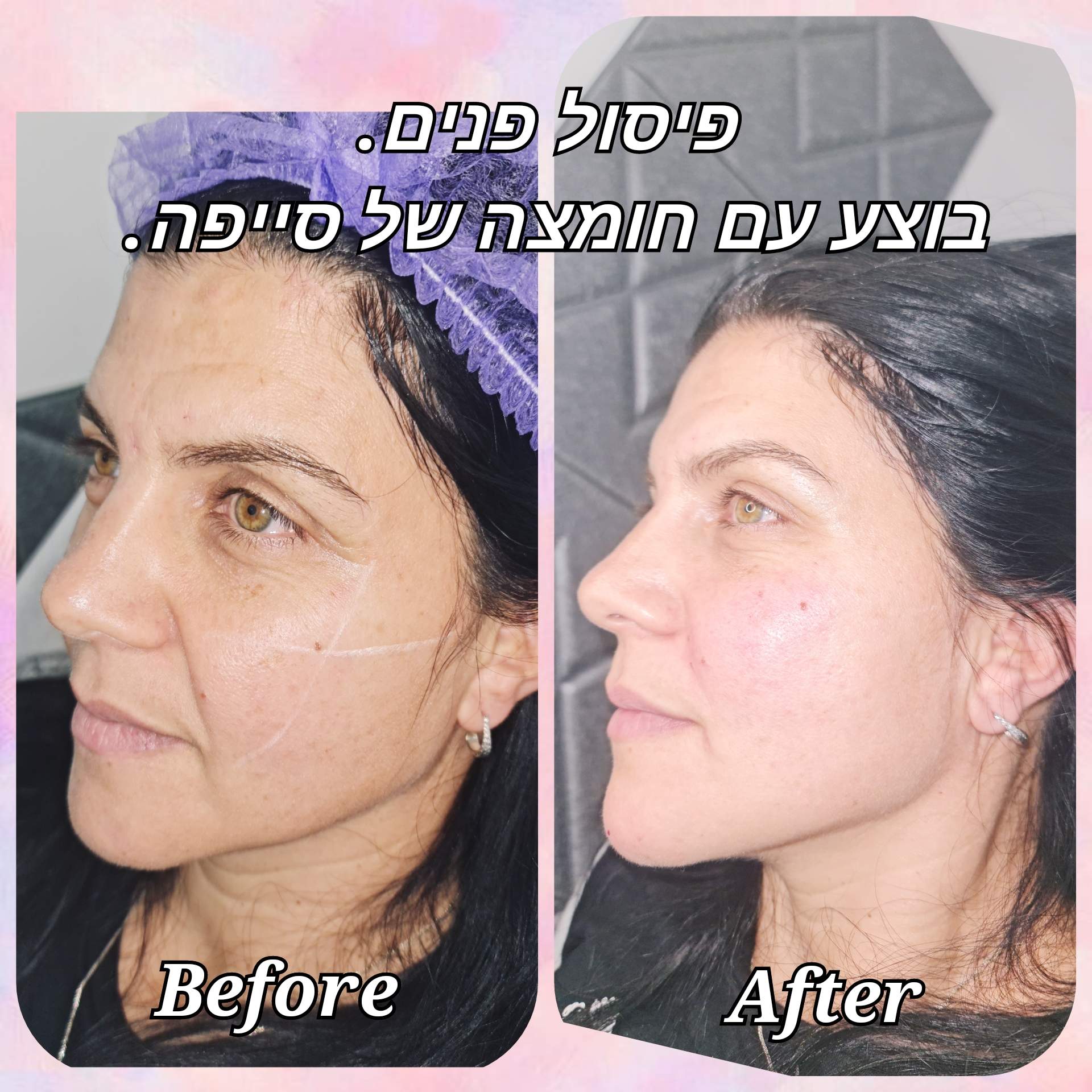 Aesthetic Medicine | Dr. Eitan Levitas