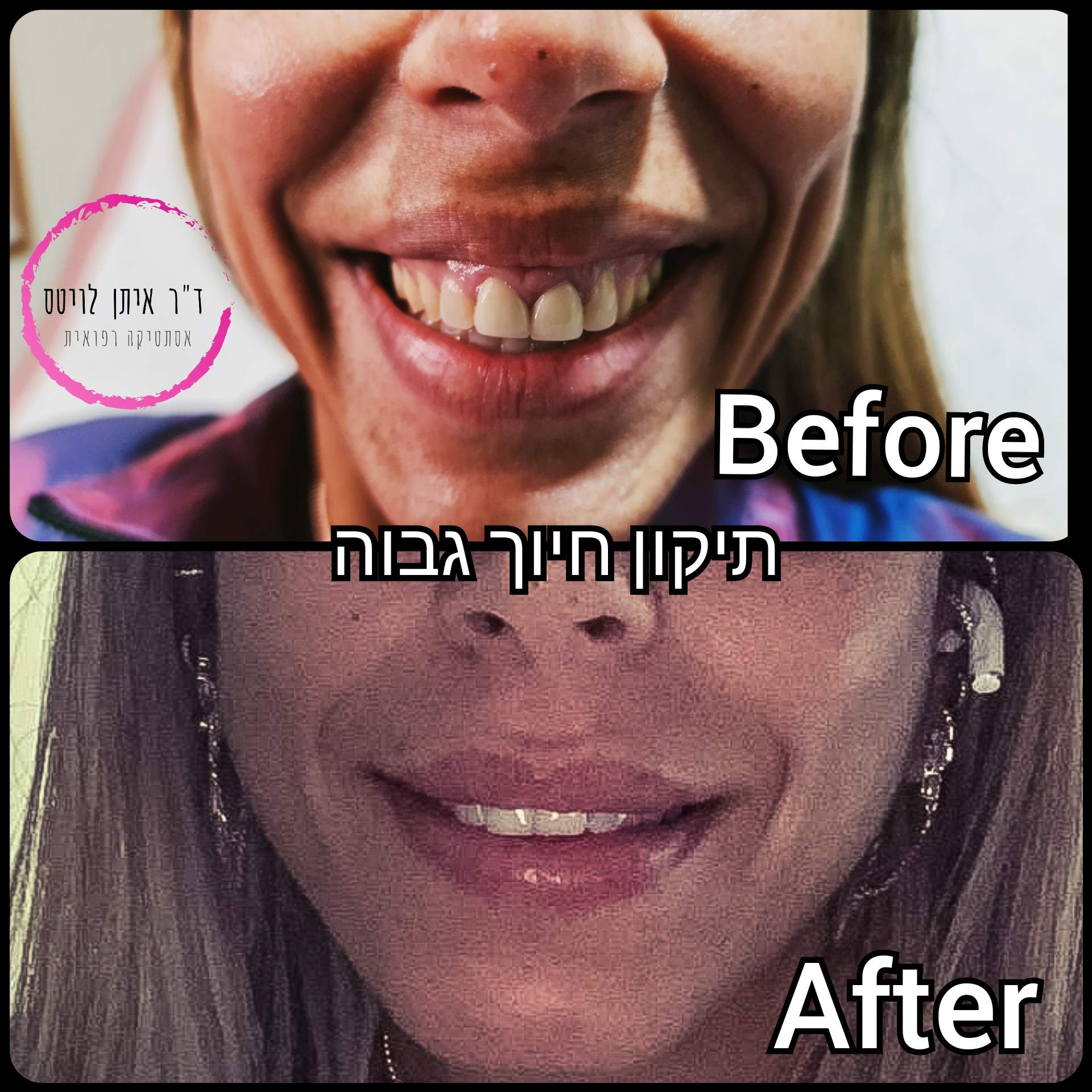 Aesthetic Medicine | Dr. Eitan Levitas