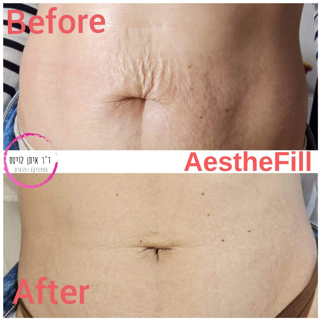 Aesthetic Medicine | Dr. Eitan Levitas