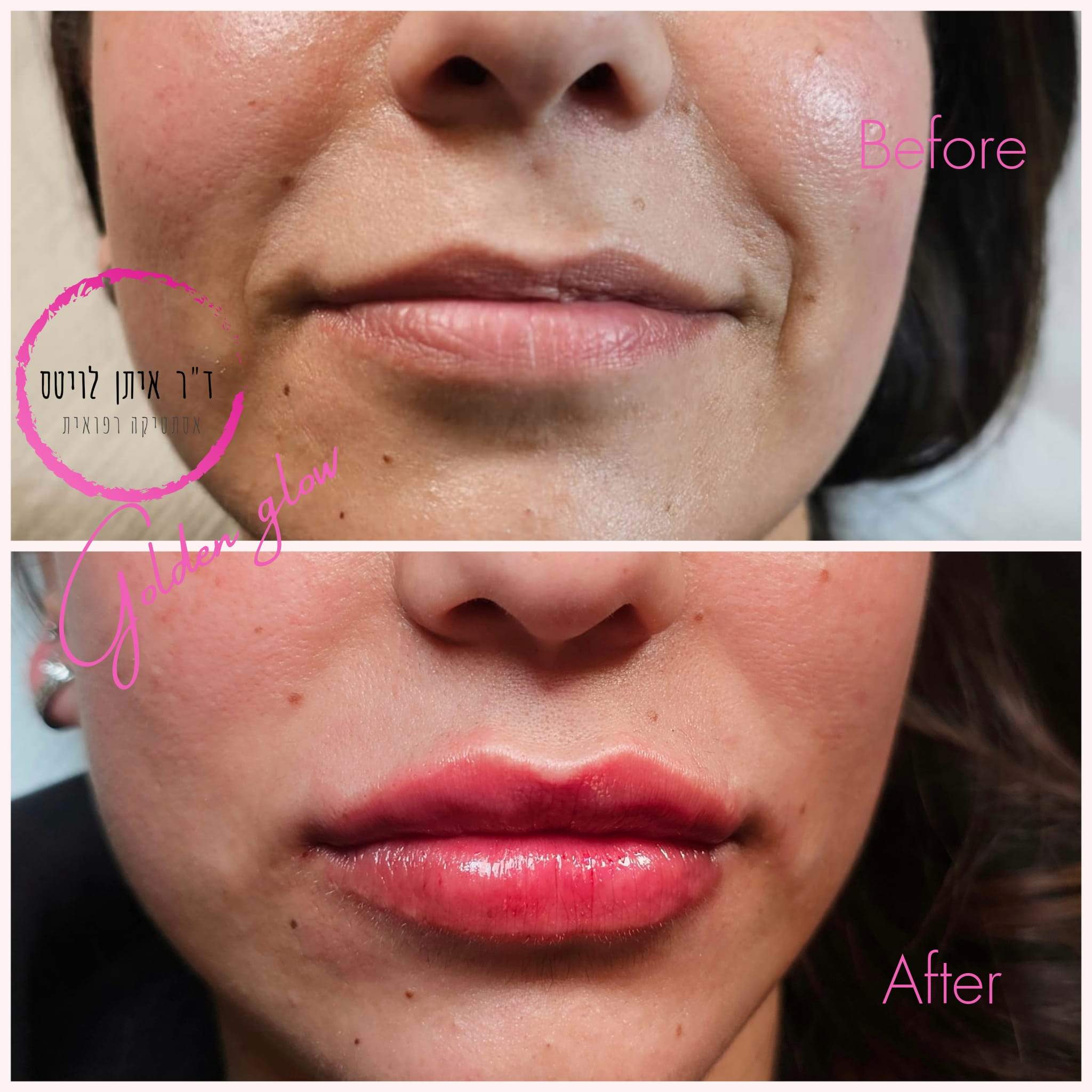 Aesthetic Medicine | Dr. Eitan Levitas