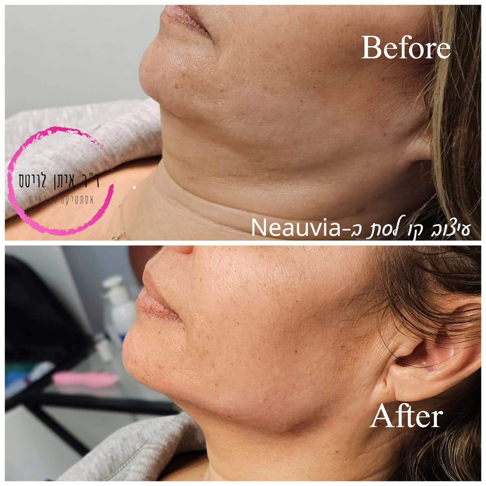 Aesthetic Medicine | Dr. Eitan Levitas