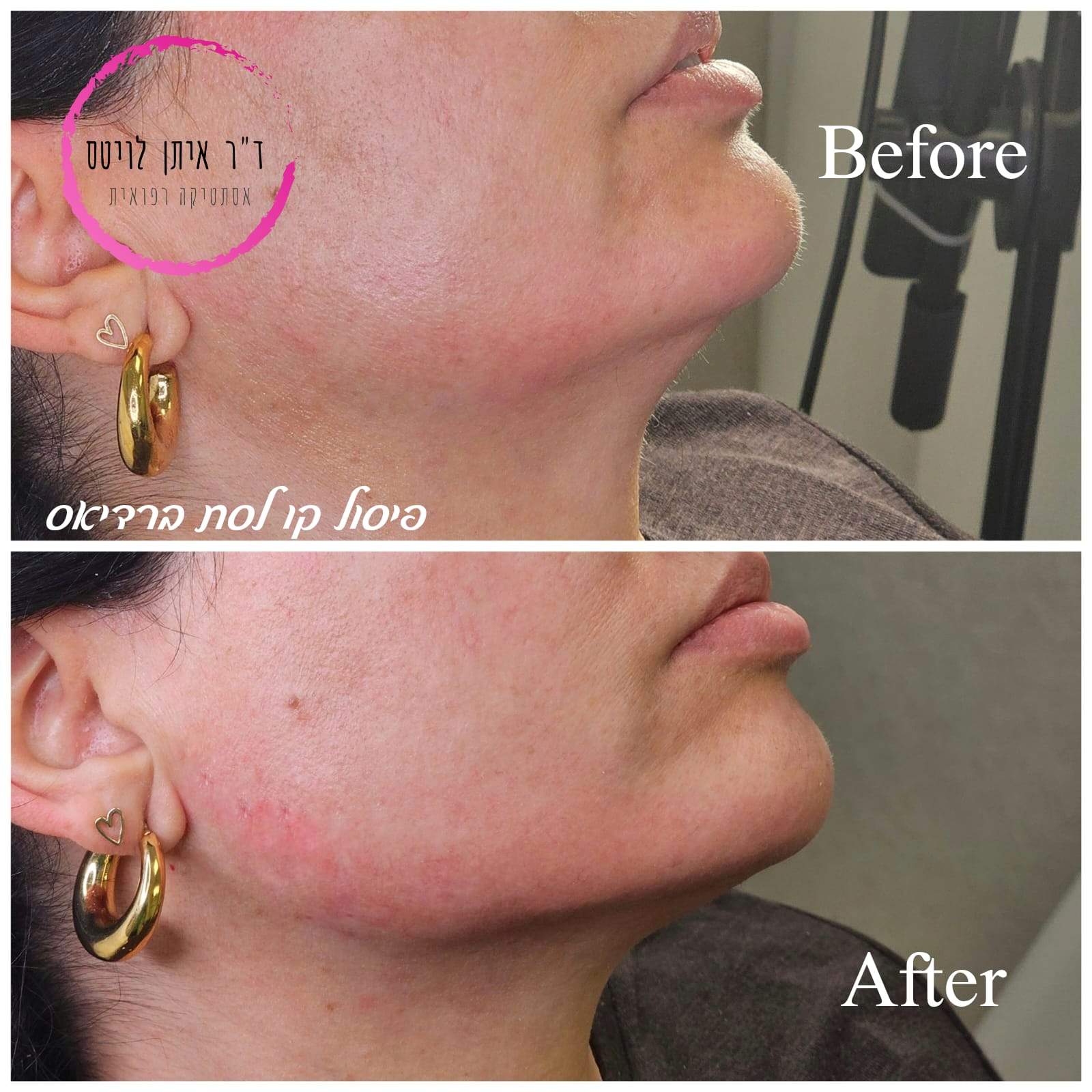 Aesthetic Medicine | Dr. Eitan Levitas