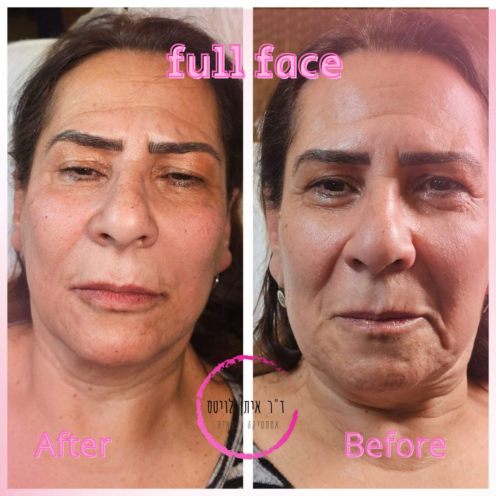 Aesthetic Medicine | Dr. Eitan Levitas