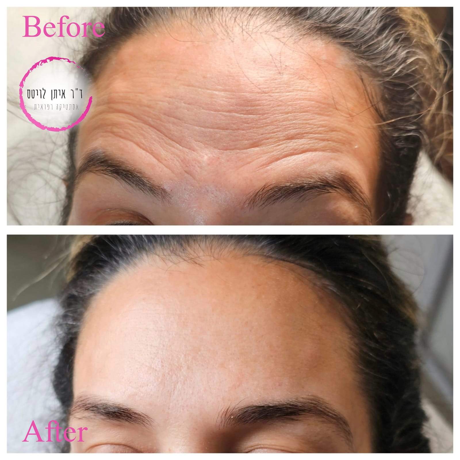 Aesthetic Medicine | Dr. Eitan Levitas