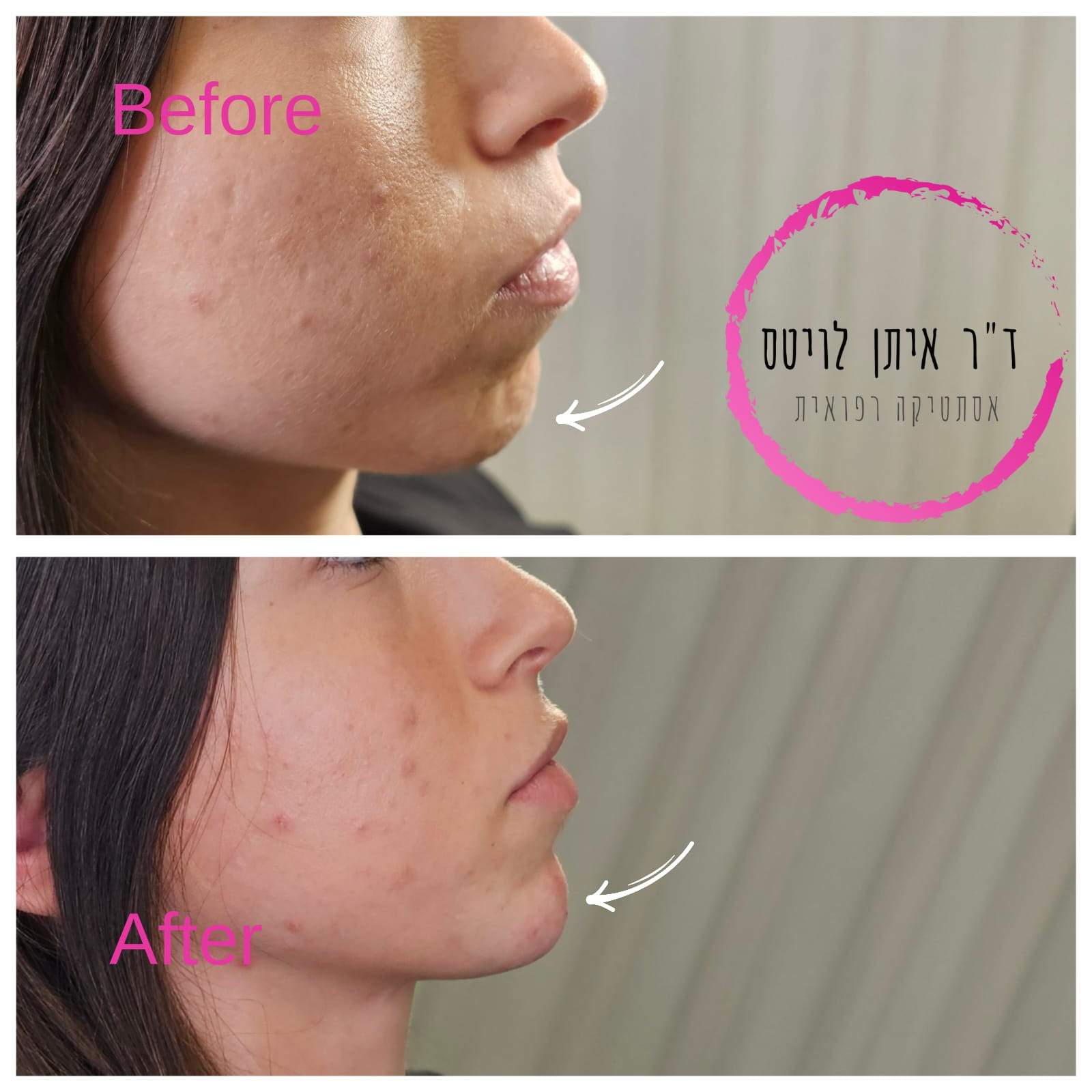 Aesthetic Medicine | Dr. Eitan Levitas