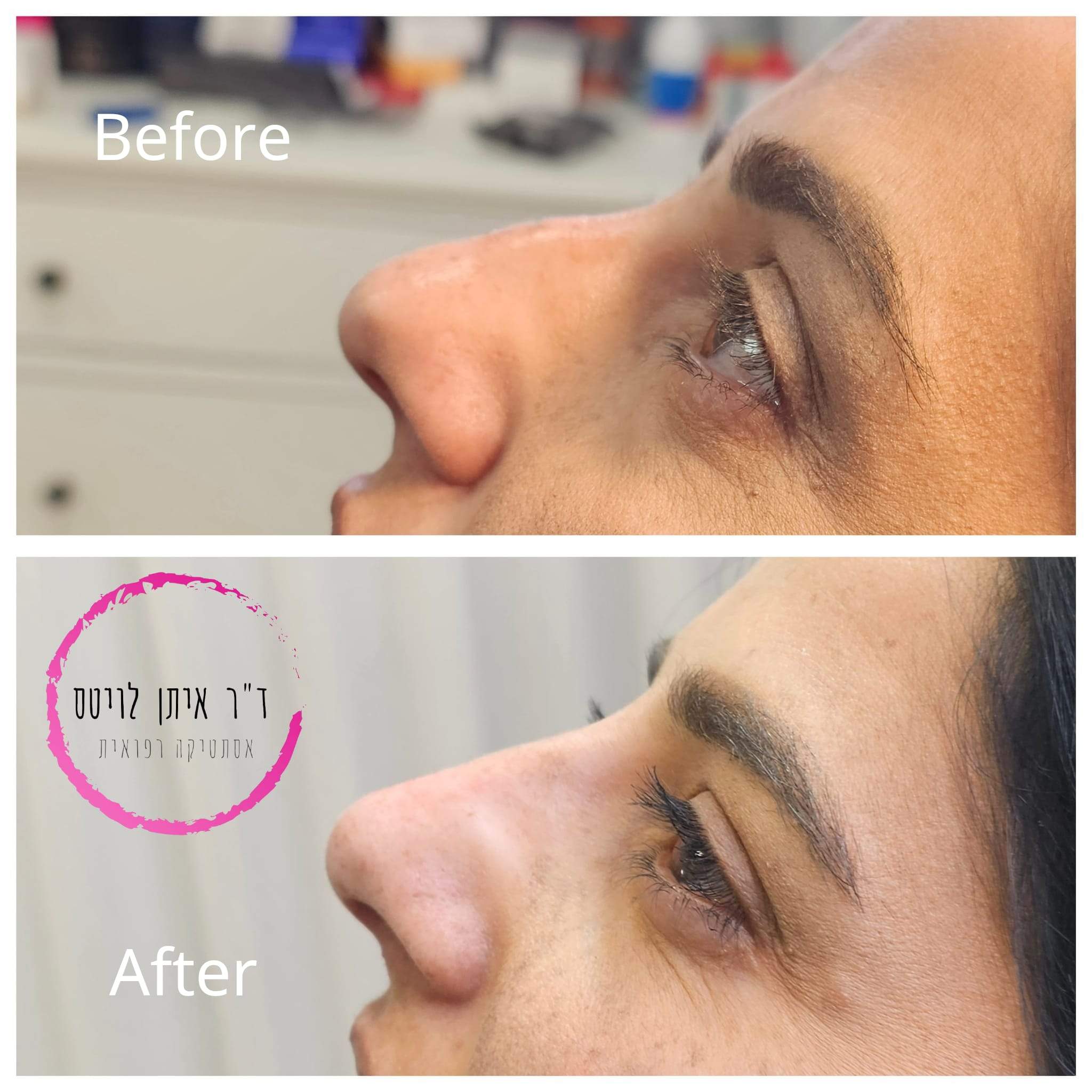 طب التجميل | د. إيتان لفيتس