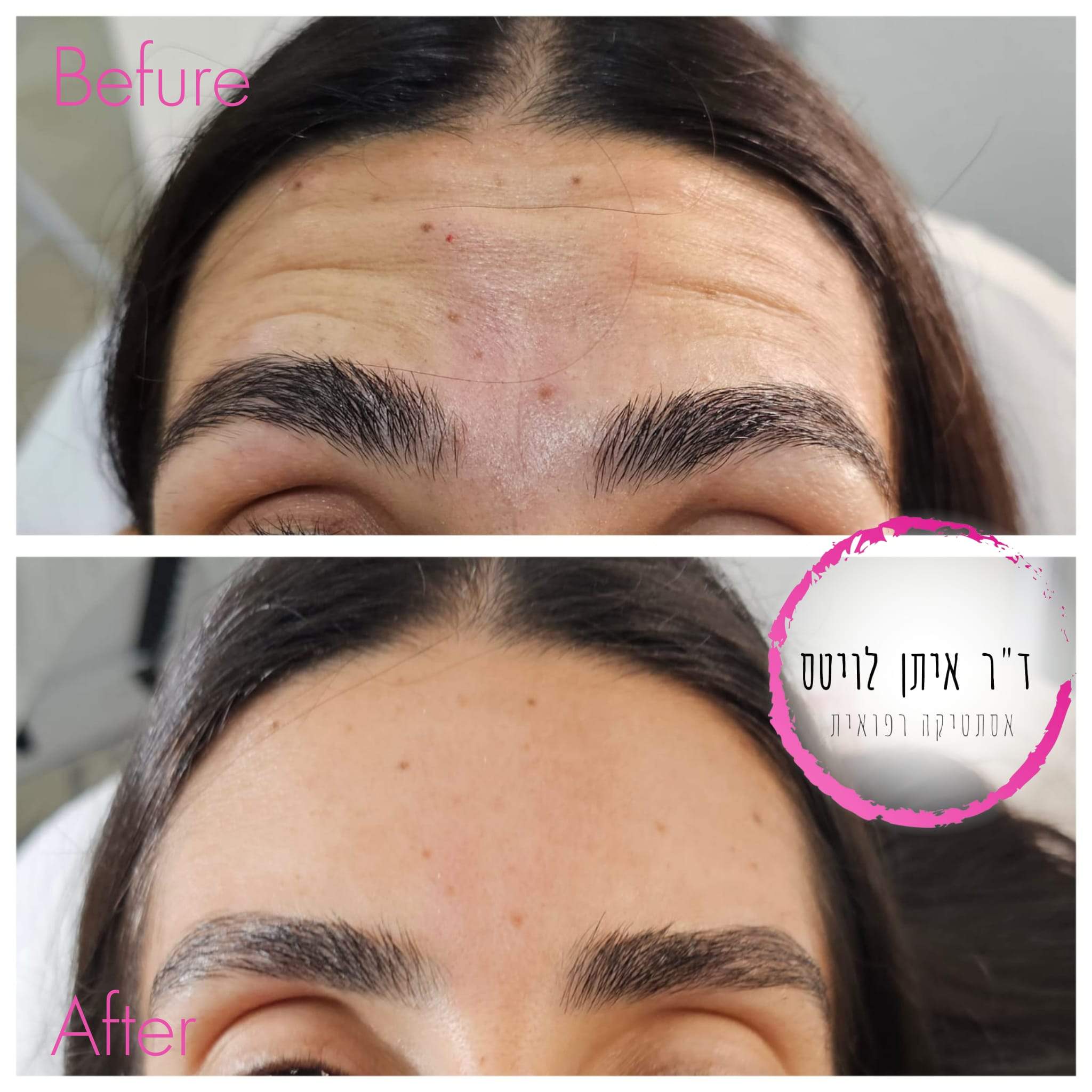 Aesthetic Medicine | Dr. Eitan Levitas