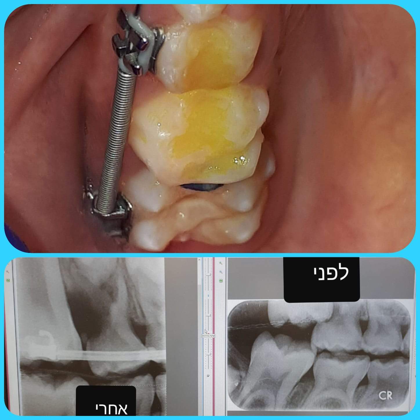 אורטודנטיה