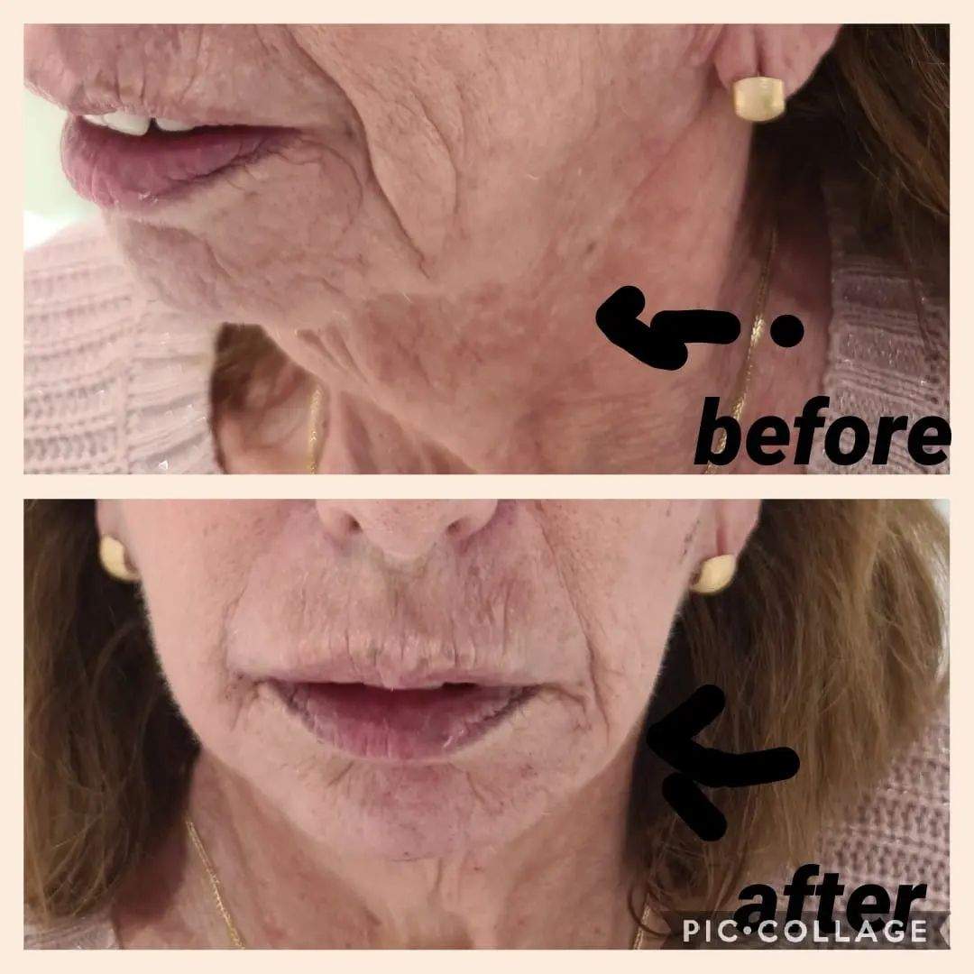 طب التجميل | د. أمين شعلان
