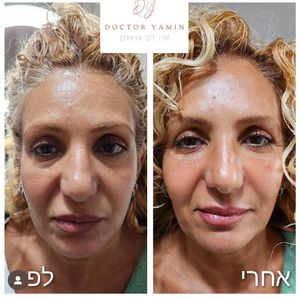 רפואה אסתטית | ד"ר עמרי ימין