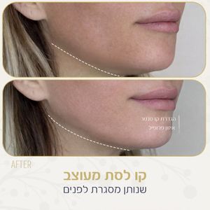 אסתטיקת פנים | ד"ר האדי עבוד