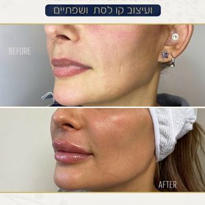 אסתטיקת פנים | ד"ר האדי עבוד