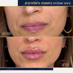 אסתטיקת פנים | ד"ר האדי עבוד