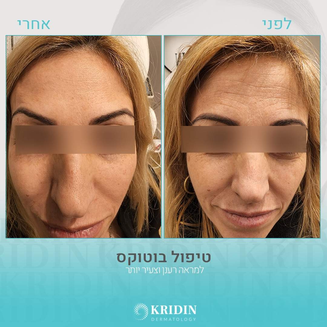 Dermatology | Prof. Khalaf Kridin