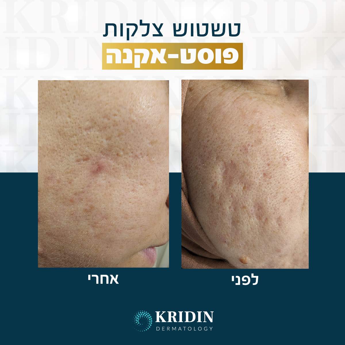 Dermatology | Prof. Khalaf Kridin