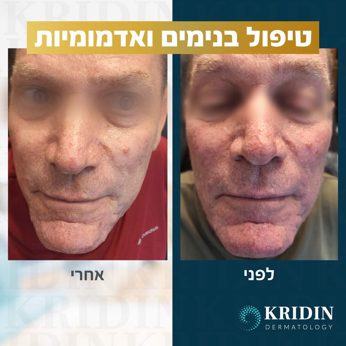 Dermatology | Prof. Khalaf Kridin