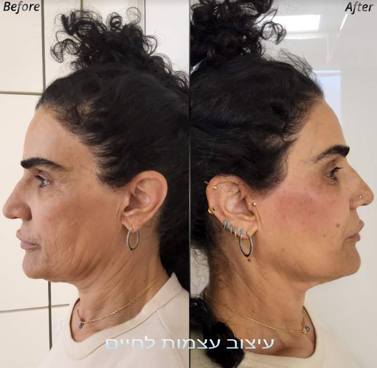 Aesthetic Medicine | Dr. Shahar Geva