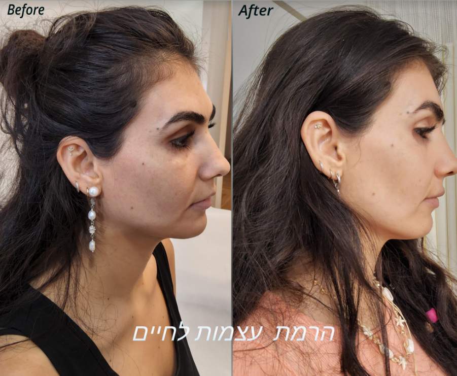 Aesthetic Medicine | Dr. Shahar Geva