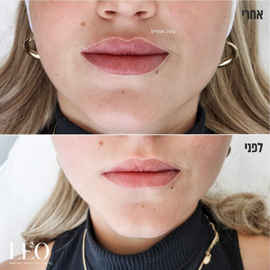 Aesthetic Medicine | Dr. Shahar Geva