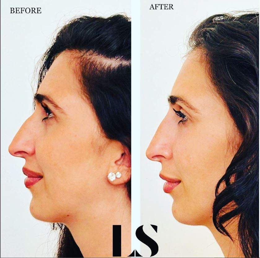 Chirurgie plastique | Dr Samuel Levy