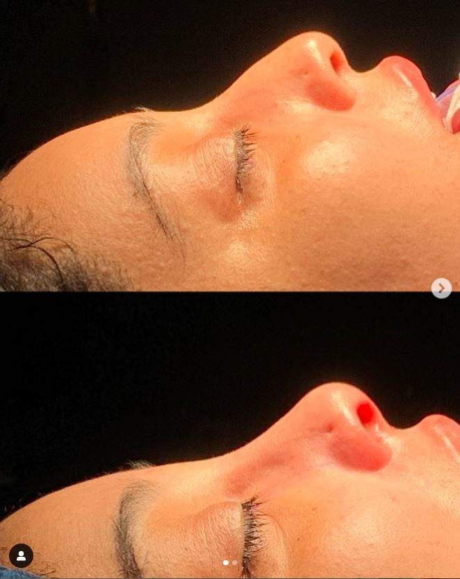 Chirurgie plastique | Dr Samuel Levy