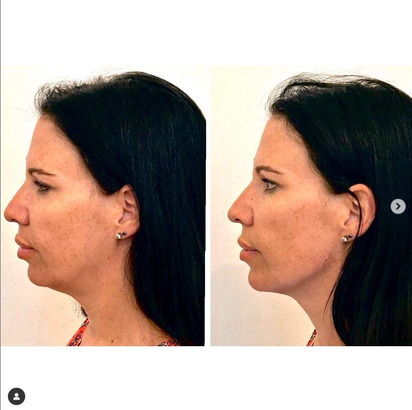Chirurgie plastique | Dr Samuel Levy