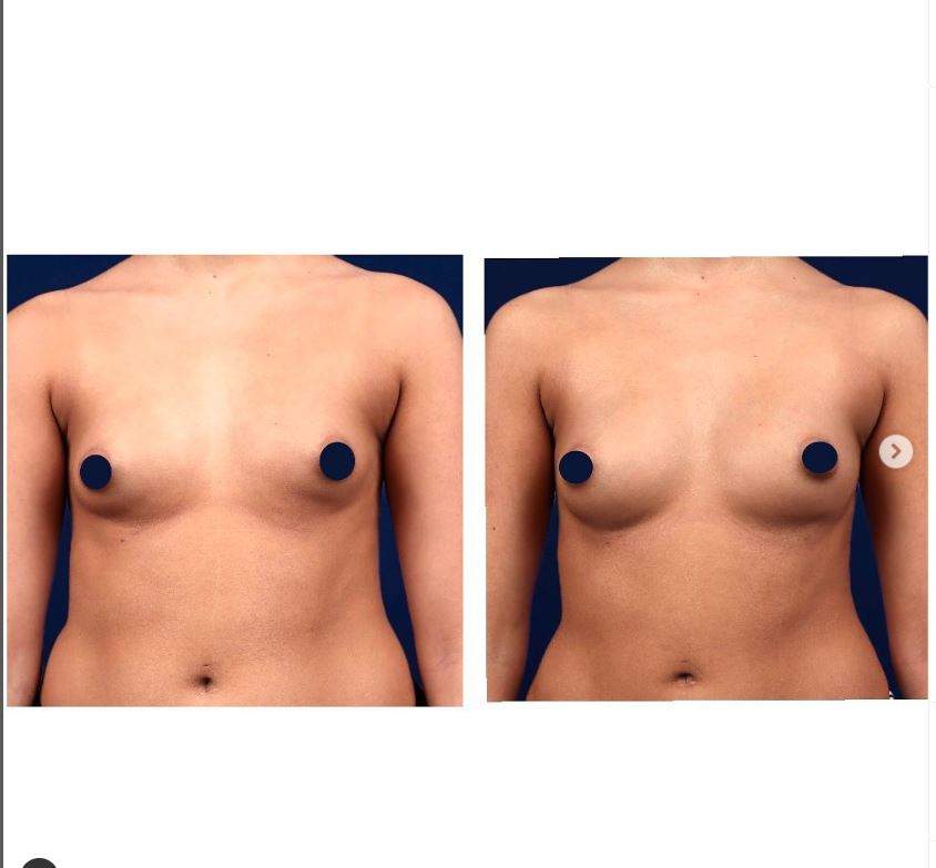 Chirurgie plastique | Dr Samuel Levy