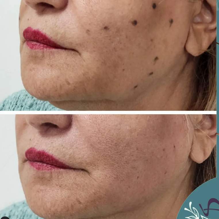 Dermatology | Dr. Ihab Siam