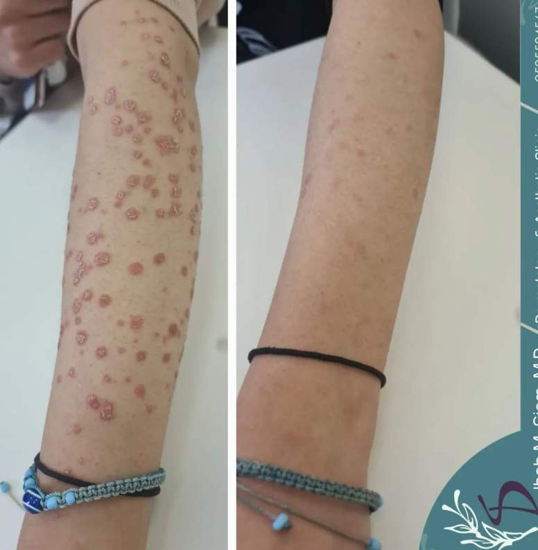 Dermatology | Dr. Ihab Siam