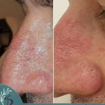Dermatology | Dr. Ihab Siam